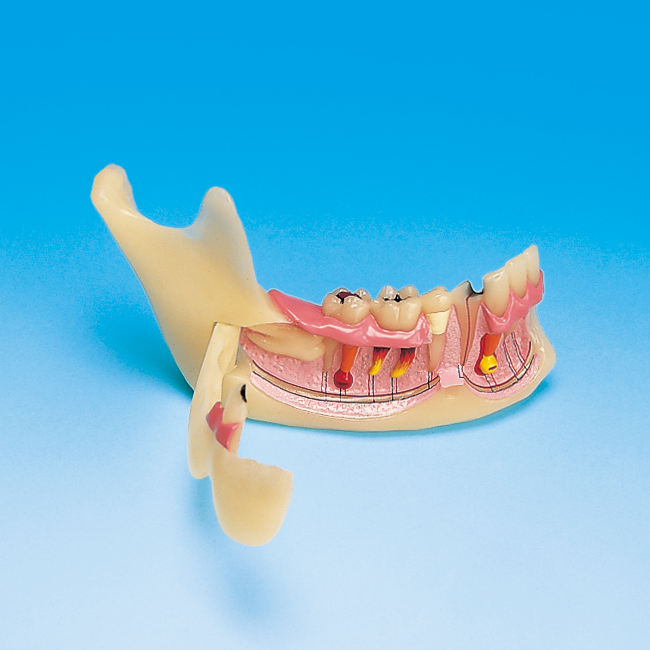 下顎骨組織模型 [PE-TDS008(P13-TR.10)]