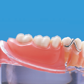 義歯の構成と支持様式の違い