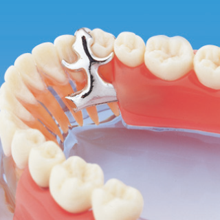 義歯の構成と支持様式の違い
