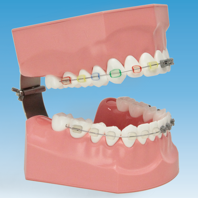 2倍大歯磨き指導用顎模型(矯正) [PE-ORT002]