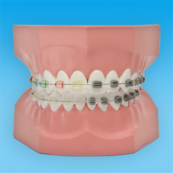 2倍大歯磨き指導用顎模型(矯正) [PE-ORT002]