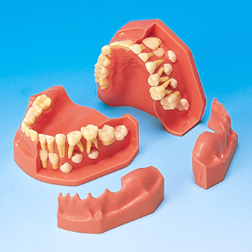 歯列発育顎模型 [PE-PDI005(P1-600B)]