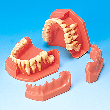 歯列発育顎模型[PE-PDI006(P1-600C)]