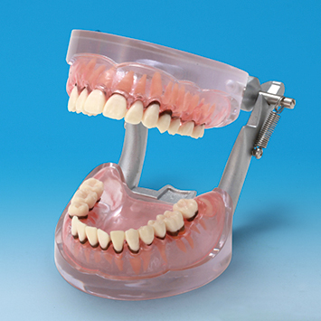 歯周病説明用顎模型 [PE-PER004]