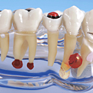 歯におよぶ様々な疾患