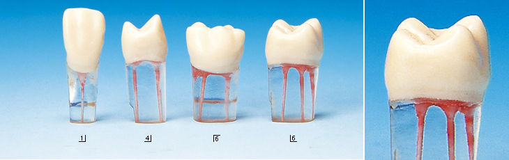 髄腔模型歯 永久歯(ネジ受けなし) [S12-500]