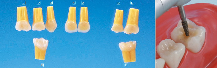 標準実習用2層模型歯 乳歯(ネジ受けなし)[A20-310]