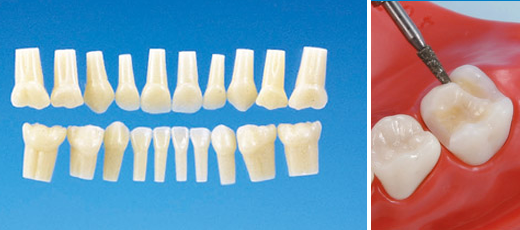 標準実習用模型歯 乳歯(ネジ受けなし) [A3-310]
