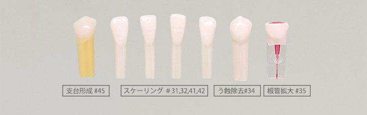 模型歯セット(7部位) [AB1-X.1635(7S)]