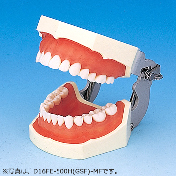SRP用顎模型 [D16HD-500H(GSF)-MF](咬合器なし)