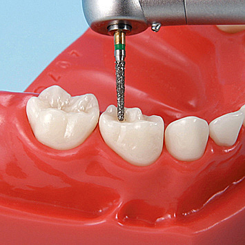 小児歯科実習用顎模型 [D5D-407C]