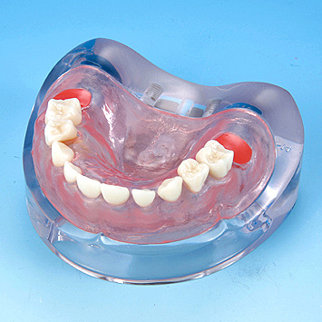 小児歯科用顎模型 [D75D-SW.K.14](D咬合器つき)