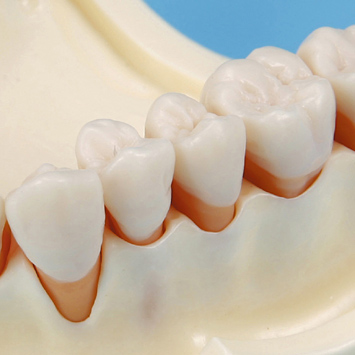 歯周外科実習用顎模型 [P15-004-PS](咬合器なし)