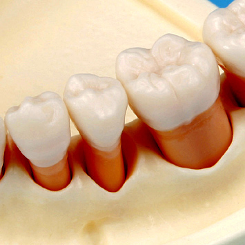歯周外科実習用顎模型 [P15FE-004-PS](FE咬合器つき)