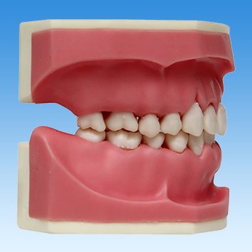 歯周病学基礎実習用顎模型(歯槽歯肉ピンク色・D咬合器つき) [PER1032-UL-SP-DM-28]