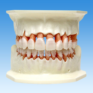歯周病学基礎実習用顎模型(歯槽歯肉ピンク色・D咬合器つき) [PER1032-UL-SP-DM-28]