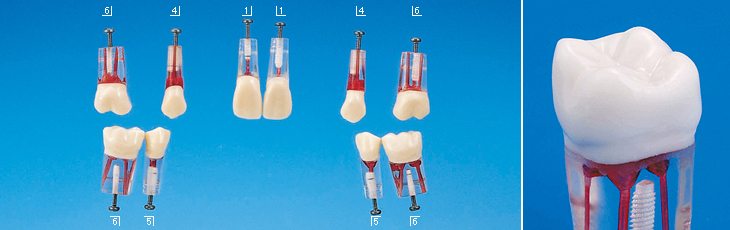 歯内療法実習用模型歯 [S12AN-500]