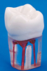 歯内療法／S12AN、A22AN