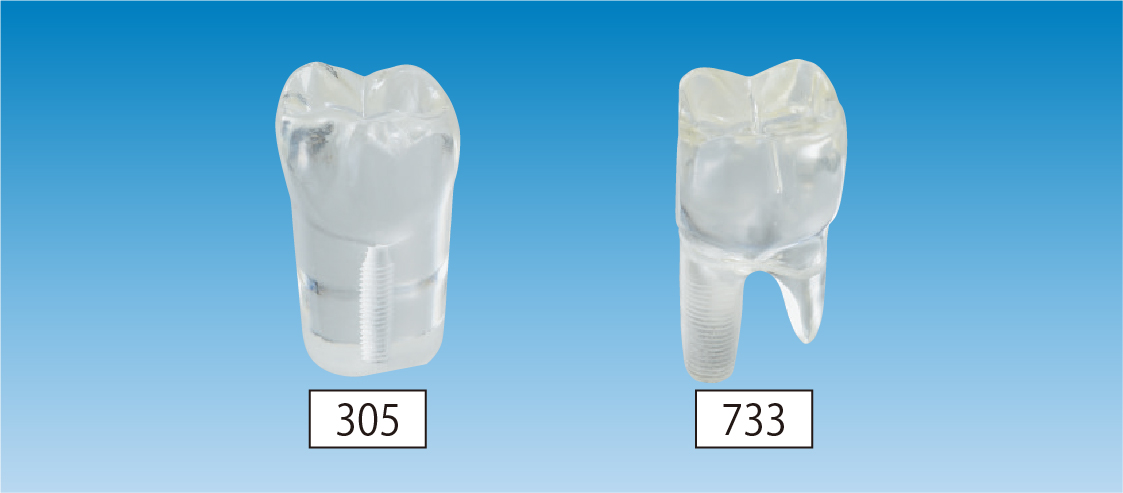 シーラント用模型歯 [A2TAN-305,378]