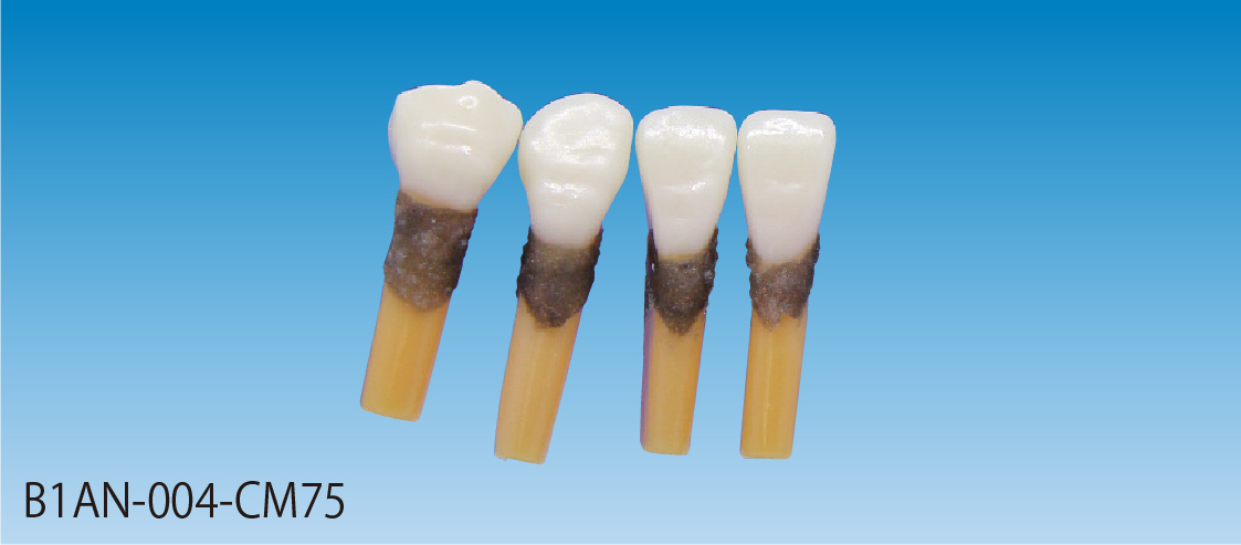 複製根模型歯 [B1AN-004-CM75]