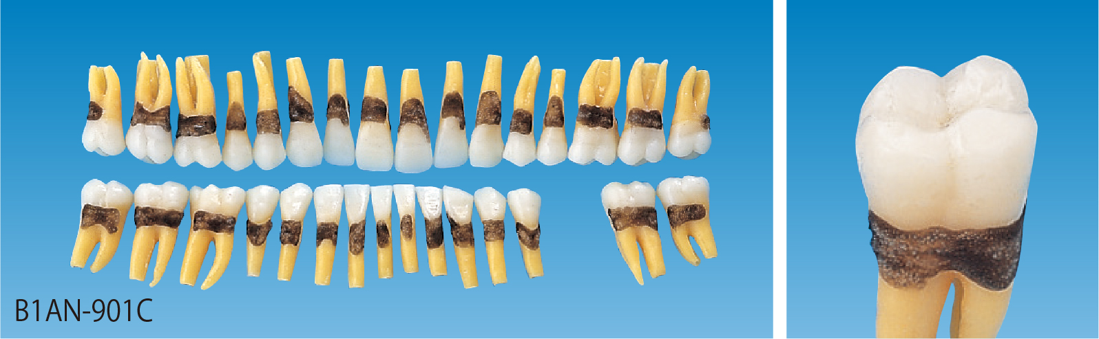 解剖学的模型歯(歯石付き) [B1AN-901C]