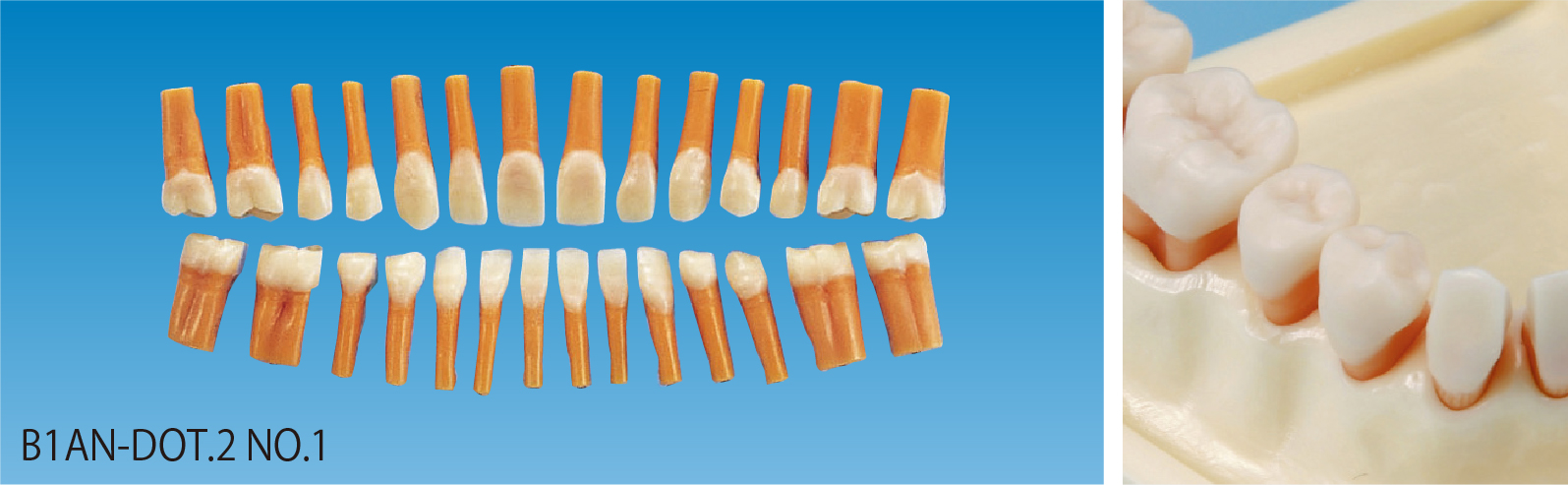 隣接面カット模型歯 [B1AN-DOT.2 NO.1]