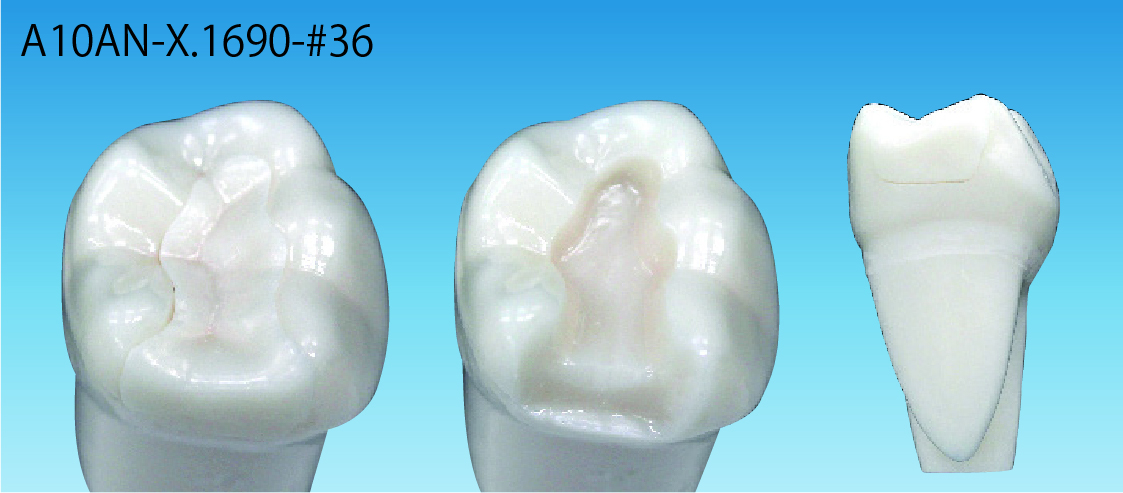 補綴物付模型歯 [A10AN-X.1690-#36]